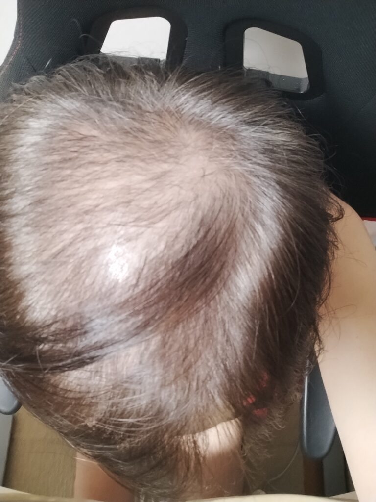約1ヶ月後ぐらい